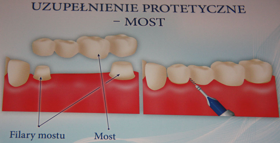 Szafir Dent - stomatologia, dentysta, rtg, mikroskop, Piła, Poznań